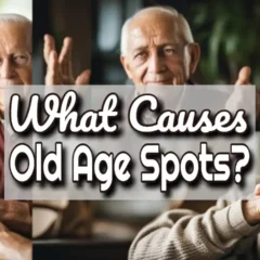 Article thumbnail with the text: "What causes old age spots".