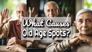 Article thumbnail with the text: "What causes old age spots".