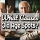 Article thumbnail with the text: "What causes old age spots".