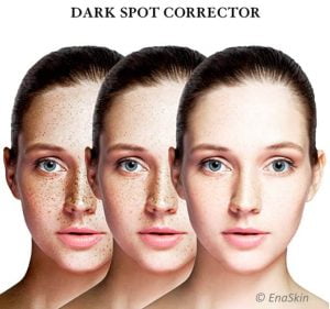 Featured image for the Dark Spot Correctors and Removers article EnaSkin vs other products.