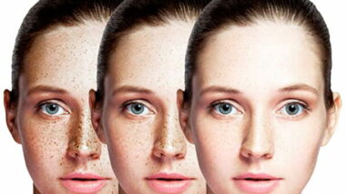 Featured image for the Dark Spot Correctors and Removers article EnaSkin vs other products.