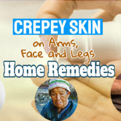 Image text says: "Crepey skin on arms eyes face legs".