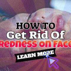 Image text: "How to get rid of redness on face".