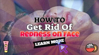 Image text: "How to get rid of redness on face".
