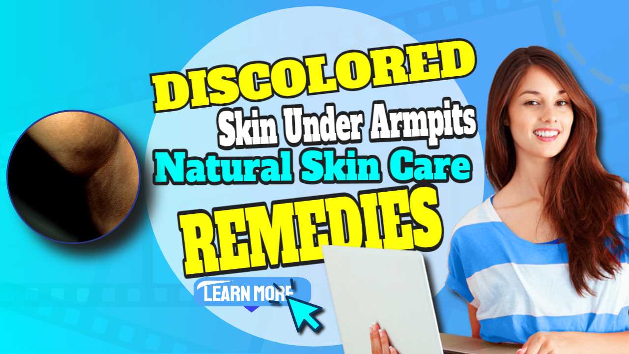 Featured image with text: "Discolored Skin Under Armpits".