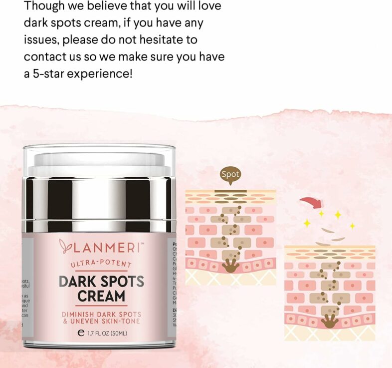 lanmeri-dark-spot-remover-review
