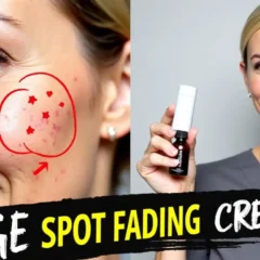 Image with text - Age Spot Fading Creams- Thumbnail